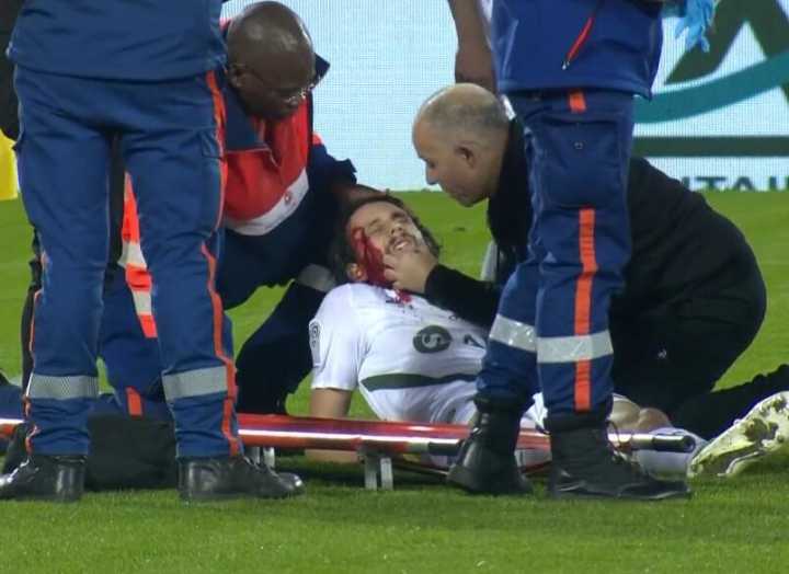 前多特中卫苏博蒂奇被队友击中面部昏迷，正在医院救治